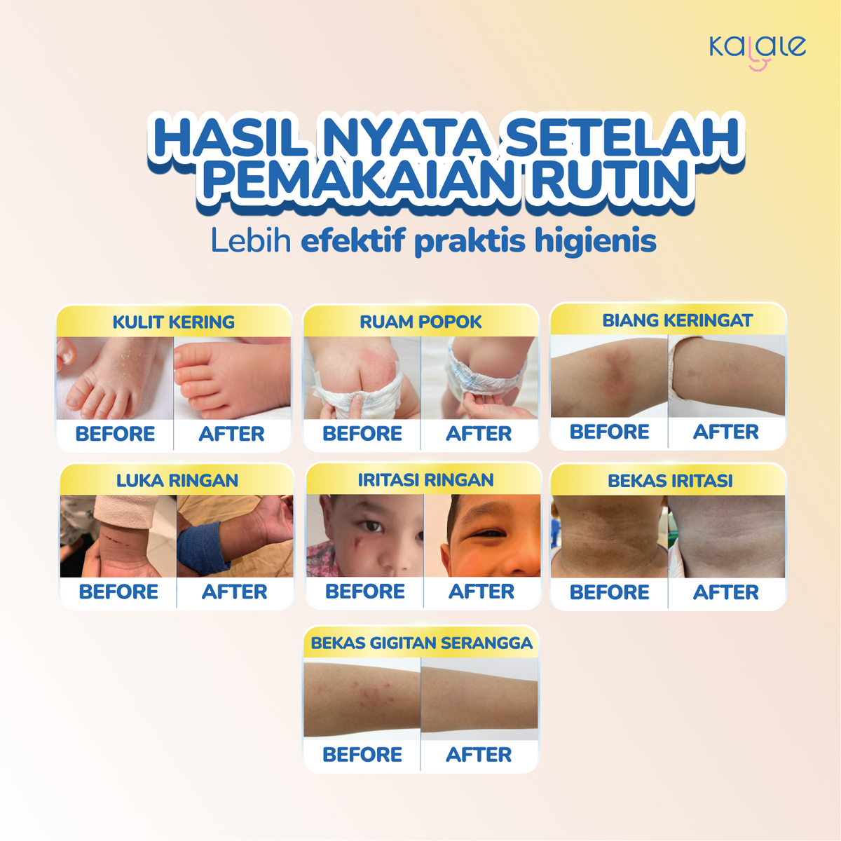 Kalale Mighty Stick Care Baby Balm – Balm Bayi Stick Higenis Praktis untuk Perawatan Kulit Harian, Kulit Kering, Ruam Popok & Iritasi Ringan - Image 3