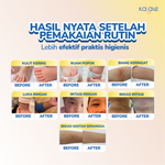 Kalale Mighty Stick Care Baby Balm – Balm Bayi Stick Higenis Praktis untuk Perawatan Kulit Harian, Kulit Kering, Ruam Popok & Iritasi Ringan thumbnail